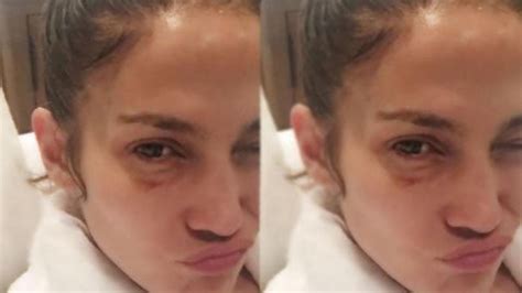 Jennifer Lopez Explains Her Black Eye: 'I'm a Fighter Too' - YouTube