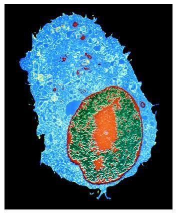 Nucleolus - Biology Encyclopedia - cells, body, function, human ...