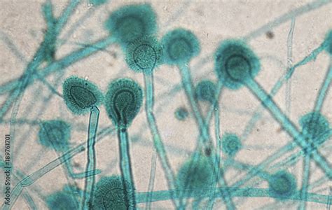 Aspergillus Microscopic