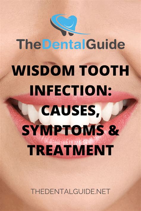 Wisdom Tooth Infection: Causes, Symptoms & Treatment - The Dental Guide