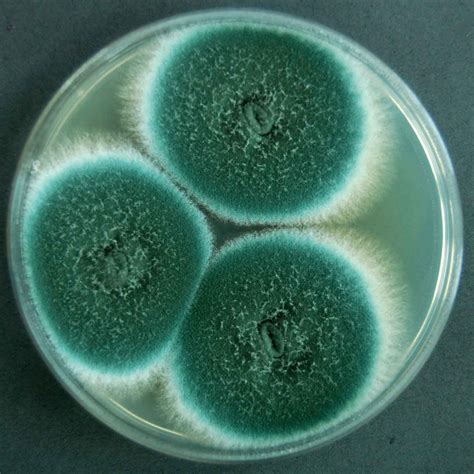 Aspergillus fumigatus