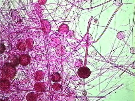 Reading: Fungi – Lab Manual for Biology Part II