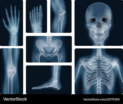 Human bones realistic x-ray shots Royalty Free Vector Image