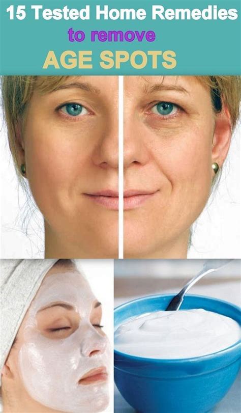 15 Tested and Effective home remedies to remove age spots, that really ...