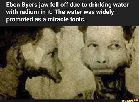 Eben Byers jaw fell off due to drinking water with radium in it. The ...