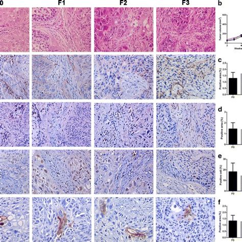 Patient-derived xenograft (PDX) mice model. a Schematic outline of the ...