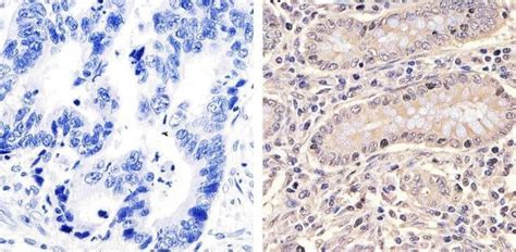 HSP70 Antibody (33-3800)