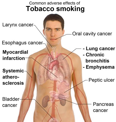 Side Effects of Smoking