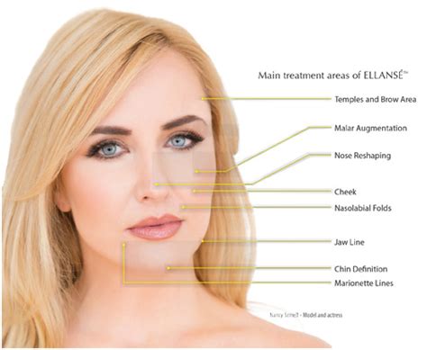 Buy wholesale: Sinclair Ellansé S, M, E, L - Dermal Filler