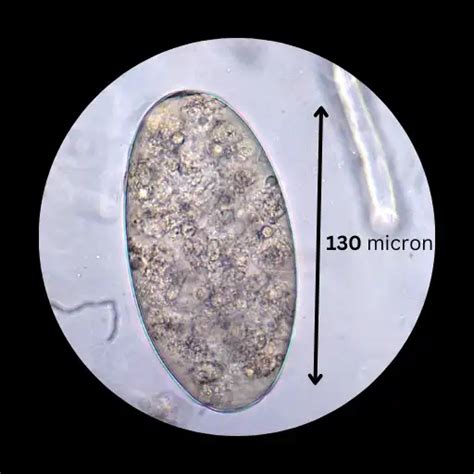 Fasciolopsis buski: A Guide to the Giant Intestinal Flukeworm Infection ...