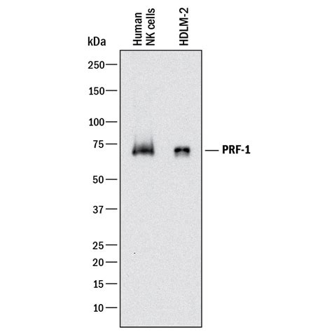 Perforin Antibodies: Novus Biologicals