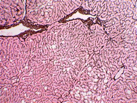 Reticulum - Histology Control Systems, Inc