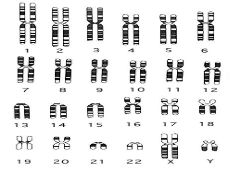 Interpretation of picture of human chromosomes - ECHEMI