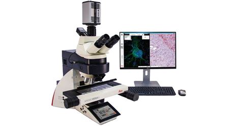 Advances in Leica Biosystems Aperio VERSA* Digital Pathology for Cancer ...