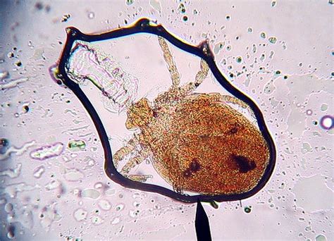 Chiggers: the Myths and the Facts! - Dave's Garden