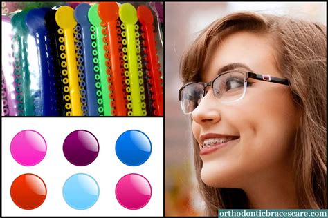 Best Braces Colors For Girls: How to choose - Orthodontic Braces Care