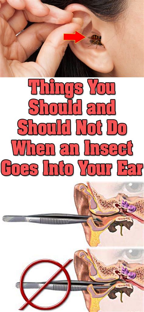 Things You Should and Should Not Do When an Insect Goes into Your Ear ...