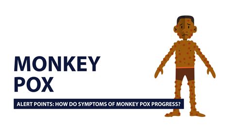 Situation Report On The MonkeyPox Outbreak In Nigeria? - Health - Nigeria