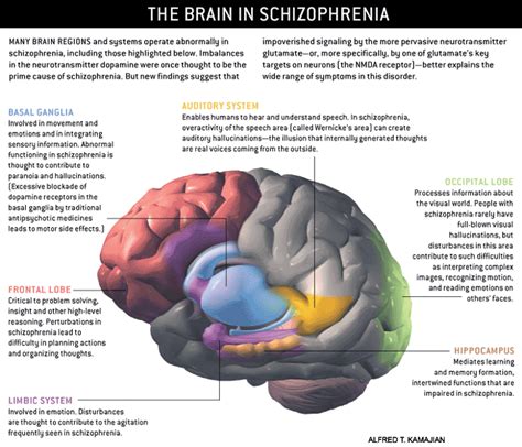 Schizophrenia - Studying the Brain