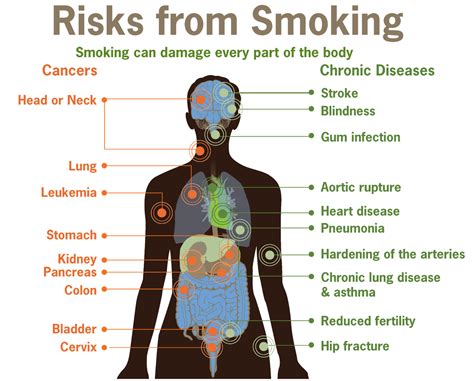 Health effects of tobacco - Wikipedia