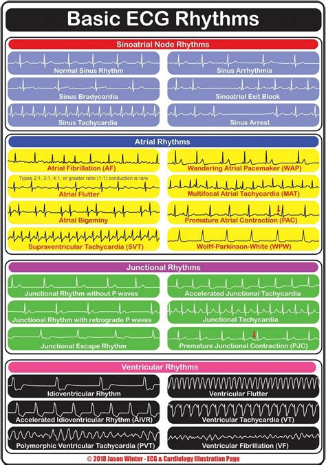 Free Printable Ekg Interpretation Cheat Sheet