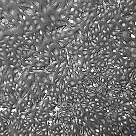 HUVEC, Human Umbilical Vein Endothelial Cells, pooled - CellSystems®