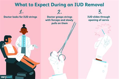 Side effects after iud insertion | IUD side effects: What they are and ...