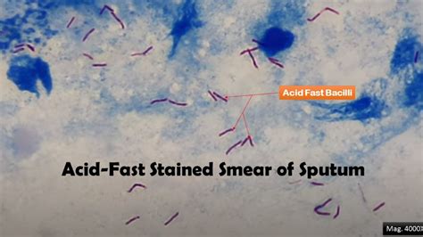 Acid-Fast Stain: Introduction, Principle, Procedure, Result Interpretation