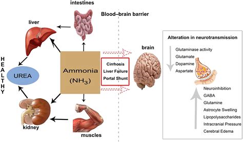 Blood Ammonia Levels Hepatic Encephalopathy