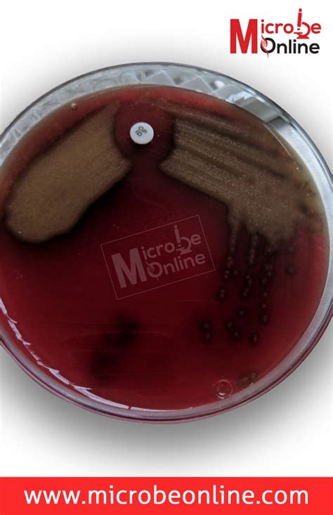 Optochin Sensitivity Test: Principle, Procedure, Results • Microbe Online