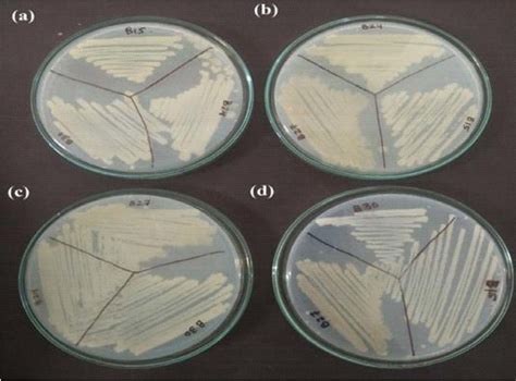 Representation of prepared consortia on nutrient agar plates; (a ...