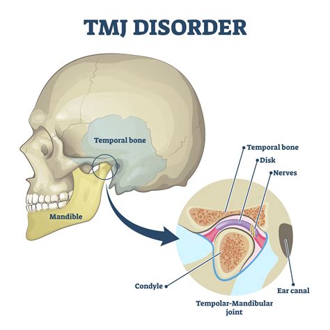 Your Guide To TMJ Disorder | Encino & San Fernando Valley, CA