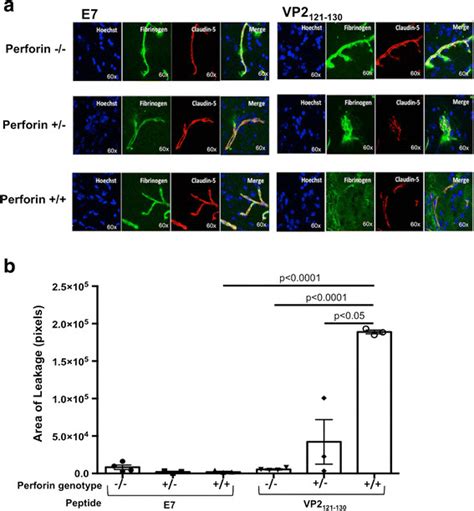 BBB tight junction protein integrity corresponds with perforin gene ...