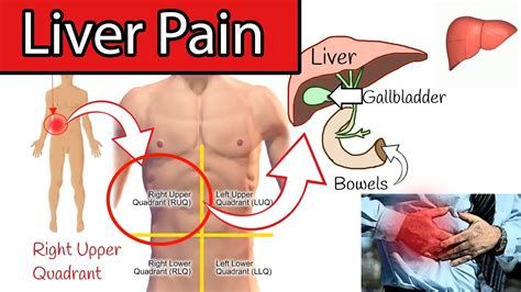 Liver Pain Location Diagram