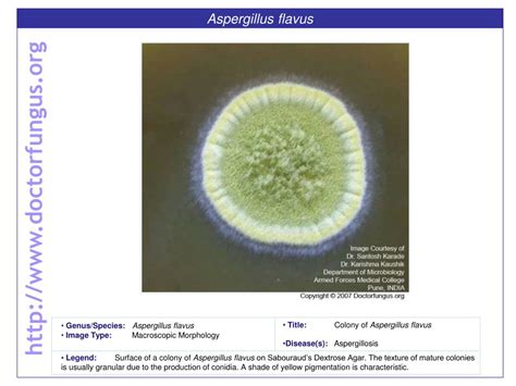 PPT - Aspergillus flavus PowerPoint Presentation - ID:664994