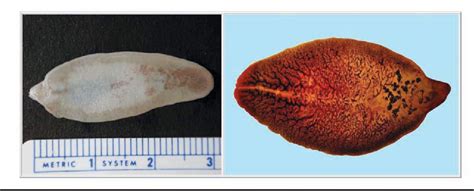 Figure 7 from Fascioliasis Due to Fasciola hepatica and Fasciola ...