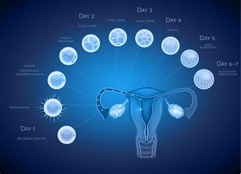 Day 3 V.s. Day 5 Embryo Transfer