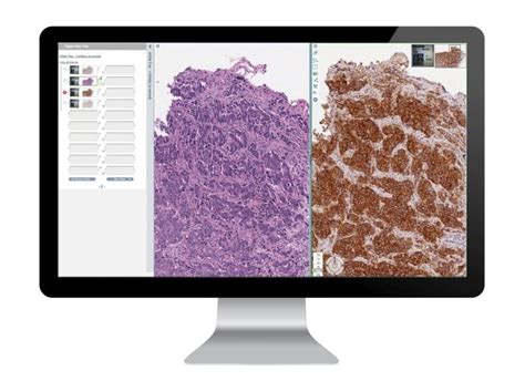 Leica Biosystems Introduces Multiple Aperio Digital Pathology Products ...