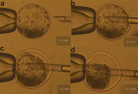 Blastocoel fluid collection of D7 expanded blastocyst (20×). a Intact ...