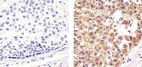 Cytochrome C Antibody (MA5-11674)