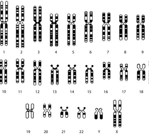 Diagrammatical representation of the human karyotype of haploid ...