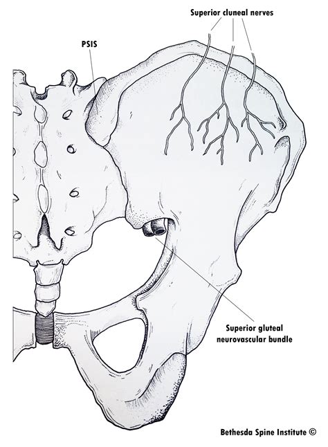 Cluneal Nerve Entrapment - Dr. William E. Morgan