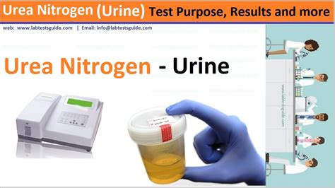 Urea (urine) Test | Lab Tests Guide