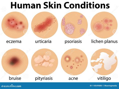 [DIAGRAM] Diagram Human Skin Conditions - MYDIAGRAM.ONLINE