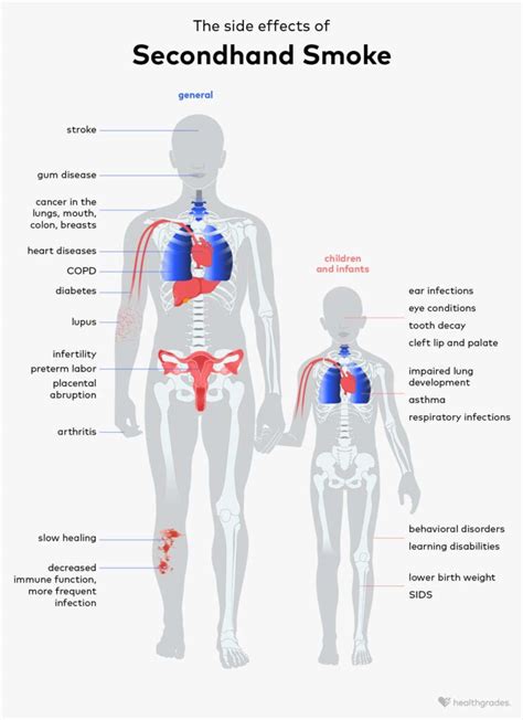 Effects of Secondhand Smoke: Dangers, Prevention, and More