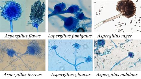 Aspergillus Flavus Under Microscope