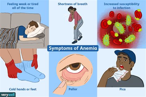 Anemia causes and methods of prevention | healthy care - healthy care