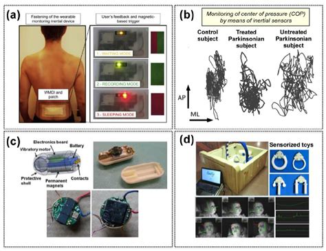 Examples of MEMS for medical applications. ( a ) Wearable monitoring ...