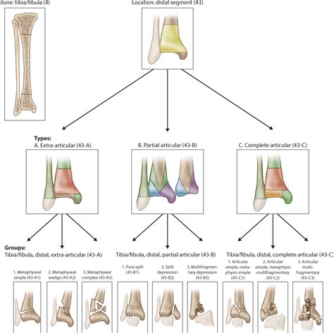 Distal Fibula Fracture Classification