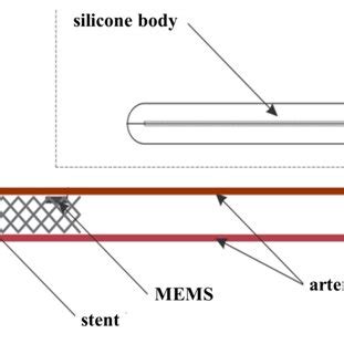 MEMS-device design. Option 1 | Download Scientific Diagram